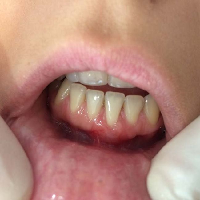 periodoncia